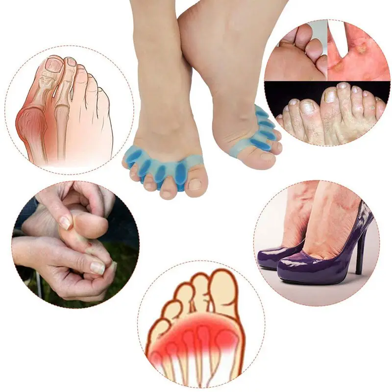 2pcs = 1pair 새로운 보호 발가락 분리기 적합 Bunion 교정기 소재 소프트 젤 Straightener 스페이서 스트레처 케어 도구