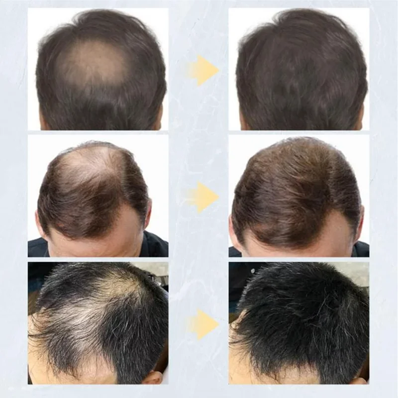 27.5g Toppik 헤어 빌딩 섬유 천연 케라틴 스타일링 파우더 손실 대머리 섬유 팩 빌딩 헤어 라인 옵티마이저 고밀도 모발 성장, 모발 성장 파우더 탈모
