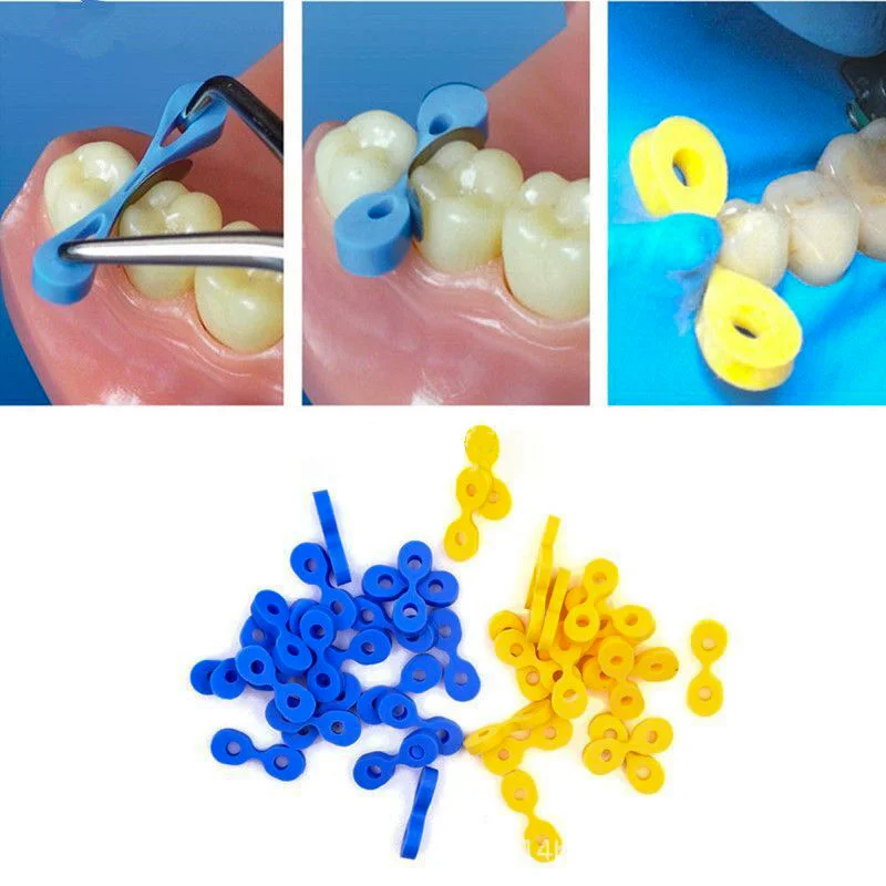 40 개/상자 치과 탄성 웨지 고무 고정 웨지 2.0/2.5 MM 매트릭스 매트릭스 댐 복합 치아 분리기 도구 title=40 개/상자 치과 탄성 웨지 고무 고정 웨지 2.0/2.5 MM 매트릭스 매트릭스 댐 복합 치아 분리기 도구 